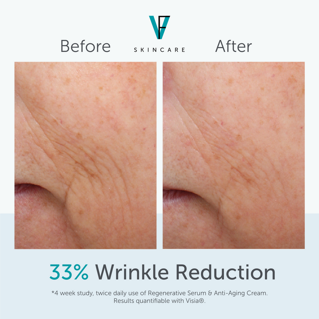 FACTORFIVE Anti-Aging Cream clinical wrinkle results