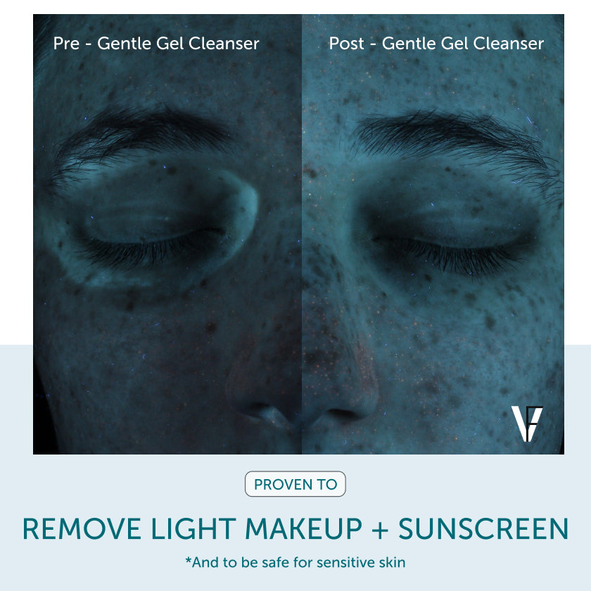 FACTORFIVE Gentle Gel Facial Cleanser supporting results image